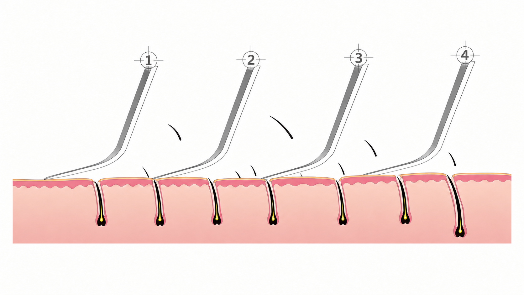 Four blade bending technique